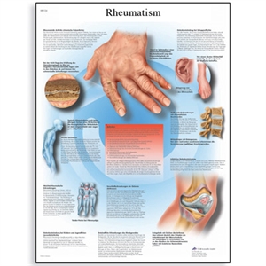 Picture of Rheumatic Diseases Chart