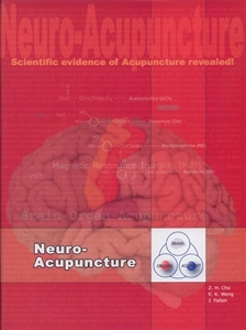 Picture of Neuro - Acupuncture