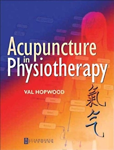 Picture of Acupuncture in physiotherapy