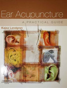Picture of Ear acupuncture